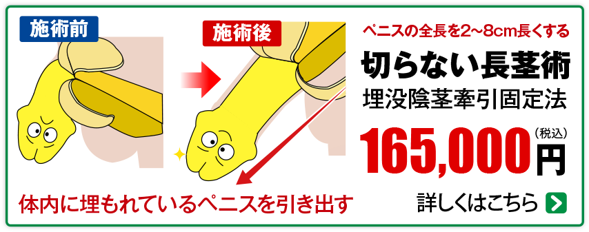切らない長茎術
                        165,000                        円