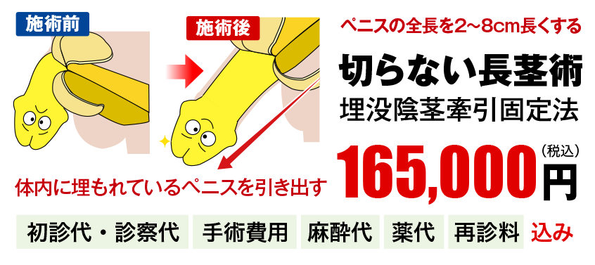 包茎も改善！切らない長茎術