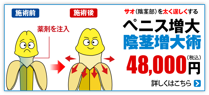 ペニス増大 陰茎増大術48,000円