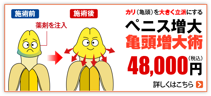 ペニス増大 亀頭増大術
                        48,000                        円