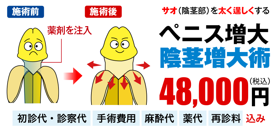 ペニス増大・陰茎増大術