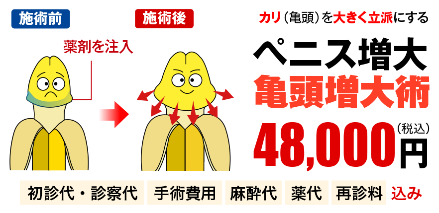 ペニス増大・亀頭増大術
