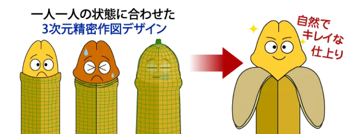 カスタム包茎手術3次元作図デザイン