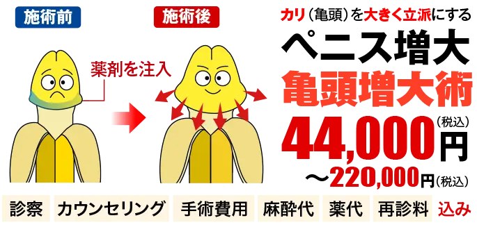 ペニス増大・亀頭増大術