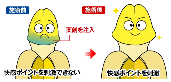 パートナーへ与える刺激増大