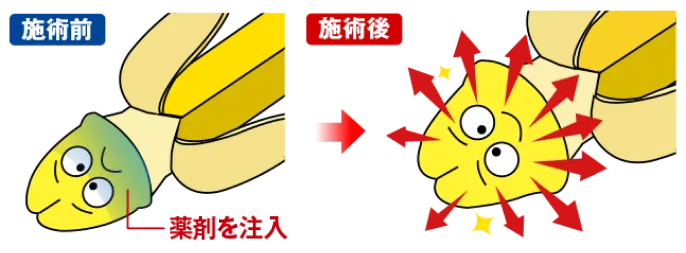 全体注入法